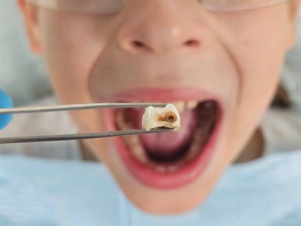 Best Emergency Gum Treatment in Brightwood, VA